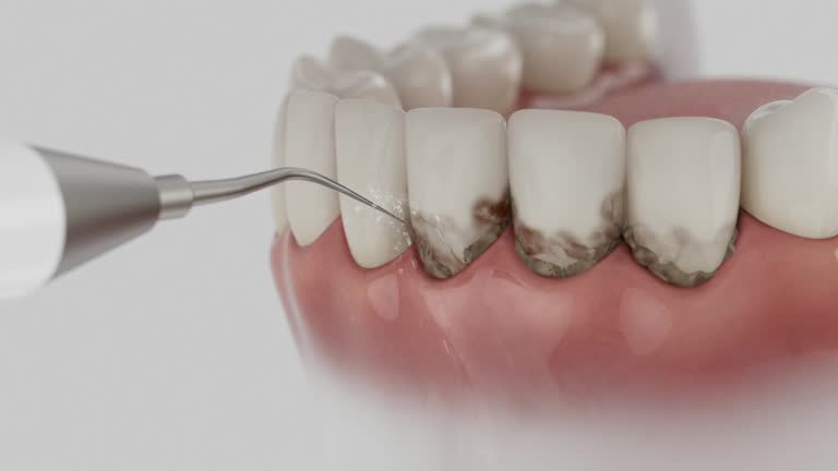 Trusted Tooth Extraction service in Lebanon, IL - Dentist Open Now